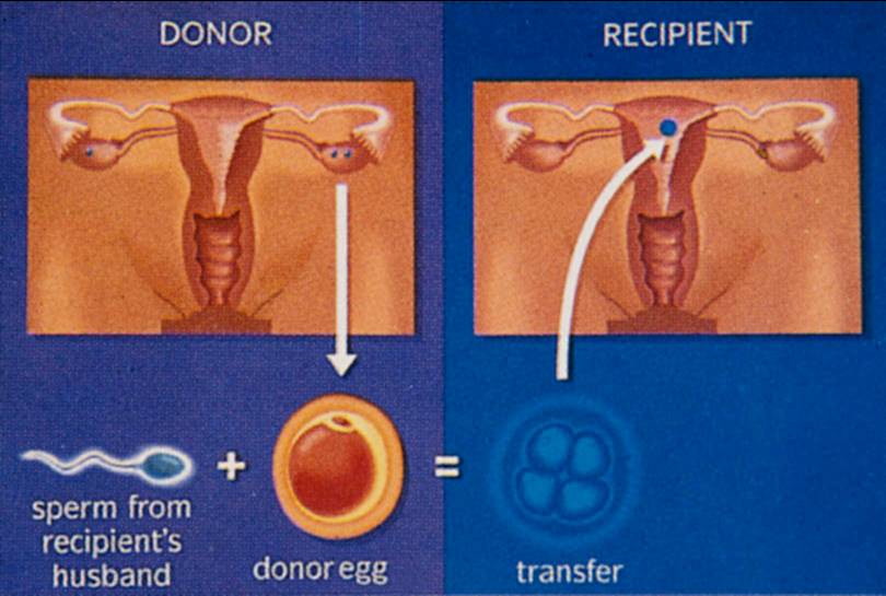 egg-donation